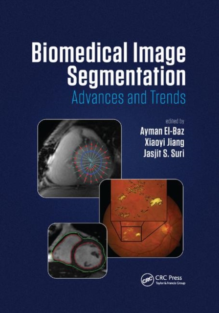 Biomedical Image Segmentation : Advances and Trends, Paperback / softback Book