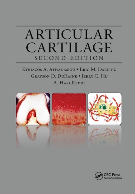 Articular Cartilage, Paperback / softback Book
