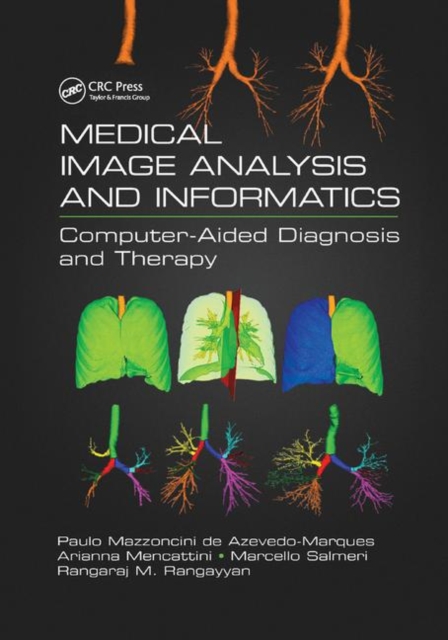 Medical Image Analysis and Informatics : Computer-Aided Diagnosis and Therapy, Paperback / softback Book