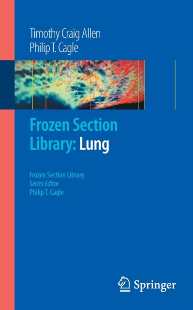 Frozen Section Library: Lung, Paperback / softback Book