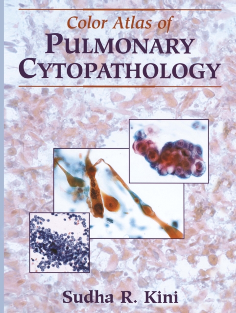 Color Atlas of Pulmonary Cytopathology, PDF eBook