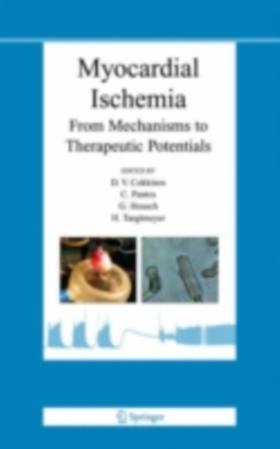 Myocardial Ischemia : From Mechanisms to Therapeutic Potentials, PDF eBook