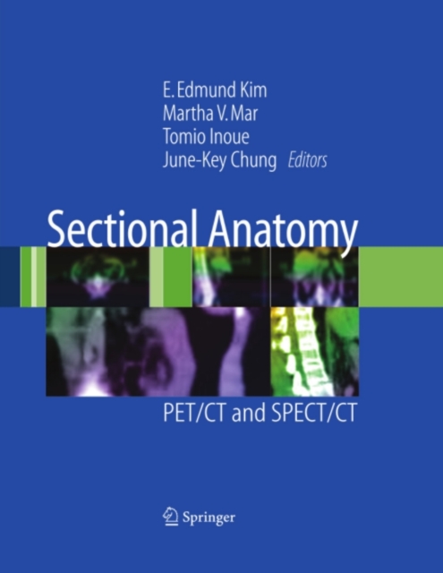 Sectional Anatomy : PET/CT and SPECT/CT, PDF eBook