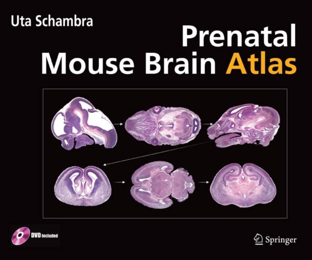 Prenatal Mouse Brain Atlas : Color images and annotated diagrams of: Gestational Days 12, 14, 16 and 18 Sagittal, coronal and horizontal section, Mixed media product Book