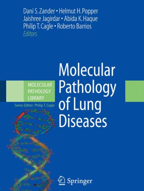 Molecular Pathology of Lung Diseases, Hardback Book