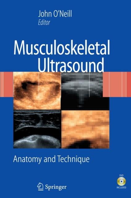 Musculoskeletal Ultrasound : Anatomy and Technique, Mixed media product Book