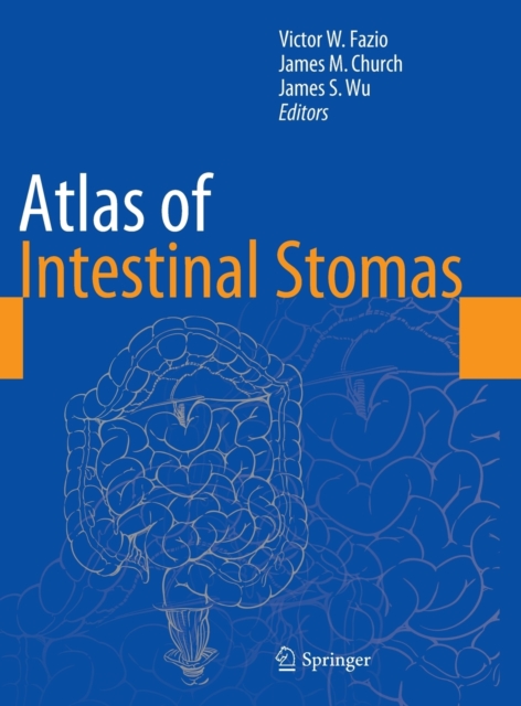 Atlas of Intestinal Stomas, Hardback Book
