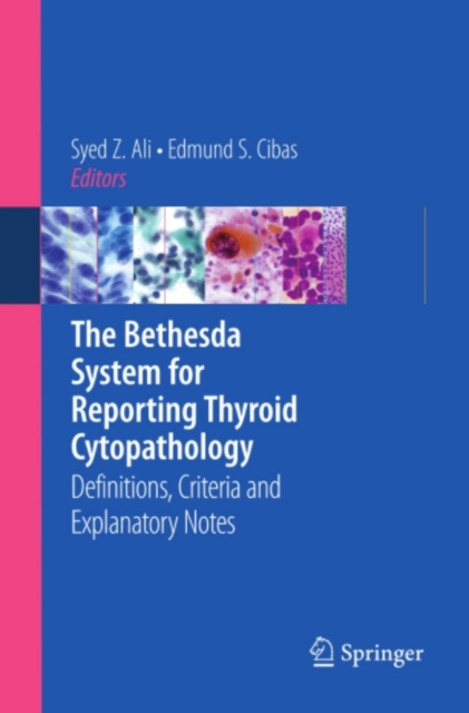 The Bethesda System for Reporting Thyroid Cytopathology : Definitions, Criteria and Explanatory Notes, PDF eBook