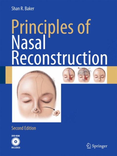 Principles of Nasal Reconstruction, Hardback Book