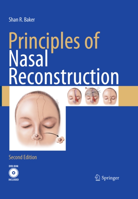 Principles of Nasal Reconstruction, PDF eBook