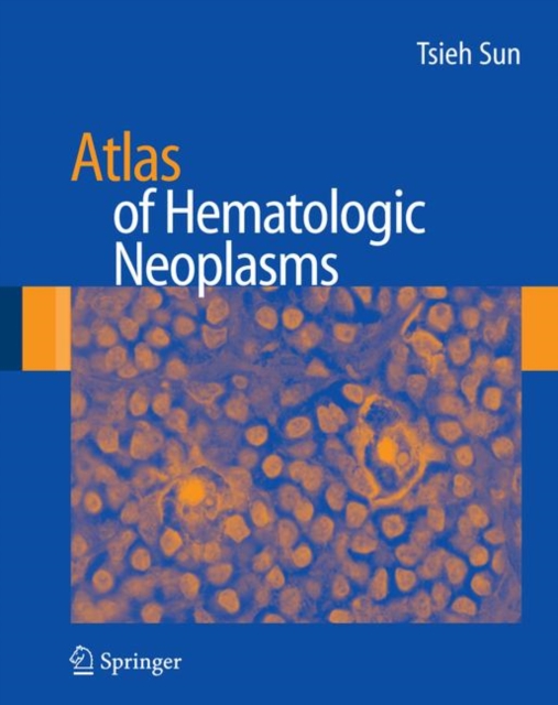 Atlas of Hematologic Neoplasms, Hardback Book