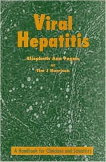 Viral Hepatitis, Paperback / softback Book