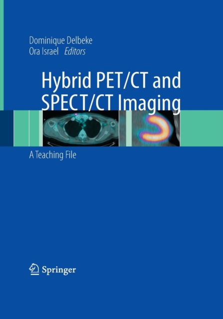 Hybrid PET/CT and SPECT/CT Imaging : A Teaching File, Mixed media product Book