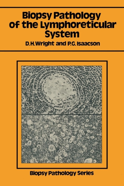 Biopsy Pathology of the Lymphoreticular System, Paperback / softback Book