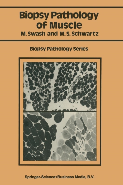 Biopsy pathology of muscle, Paperback / softback Book