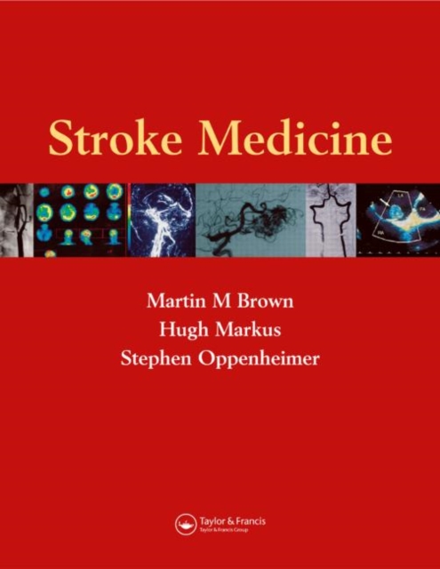 Stroke Medicine, Hardback Book