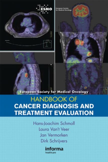 ESMO Handbook of Cancer Diagnosis and Treatment Evaluation, Paperback / softback Book