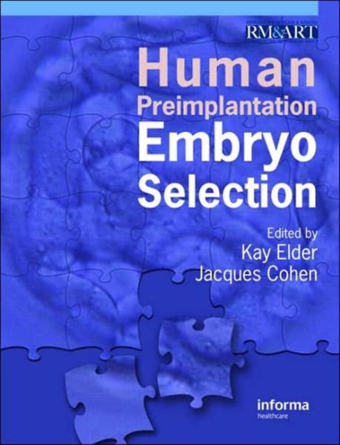 Human Preimplantation Embryo Selection, Hardback Book