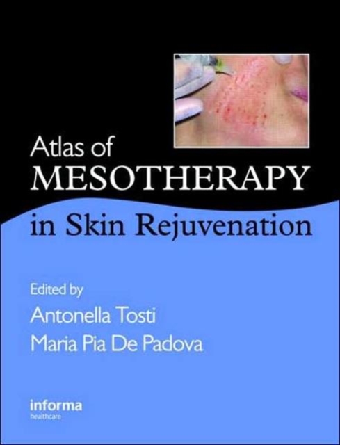 Atlas of Mesotherapy in Skin Rejuvenation, Hardback Book