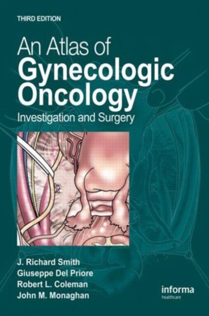 An Atlas of Gynecologic Oncology : Investigation and Surgery, Hardback Book