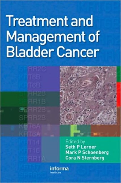 Treatment and Management of Bladder Cancer, Mixed media product Book
