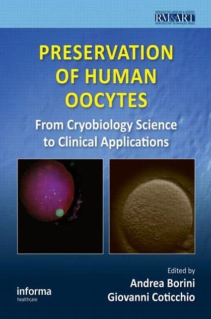 Preservation of Human Oocytes : From Cryobiology Science to Clinical Applications, Hardback Book