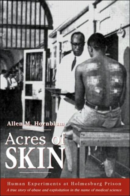Acres of Skin : Human Experiments at Holmesburg Prison, Hardback Book