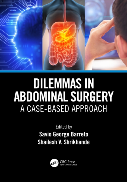 Dilemmas in Abdominal Surgery : A Case-Based Approach, PDF eBook