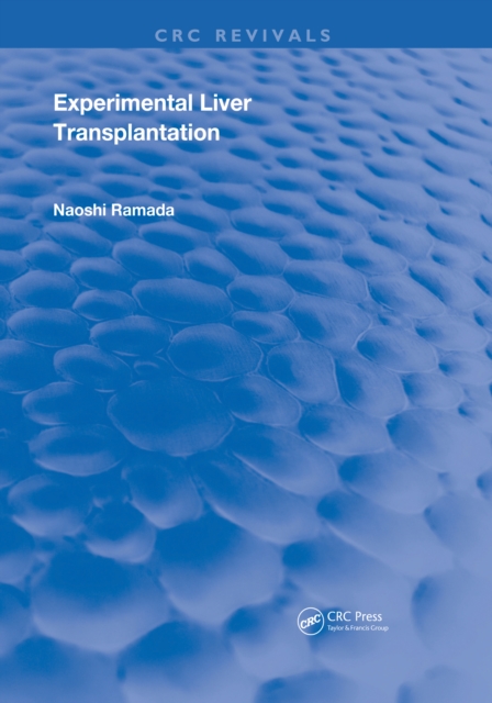 Experimental Liver Transplantation, EPUB eBook