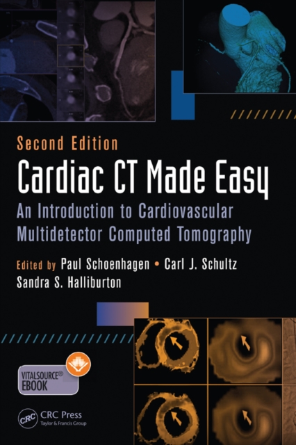 Cardiac CT Made Easy : An Introduction to Cardiovascular Multidetector Computed Tomography, Second Edition, EPUB eBook