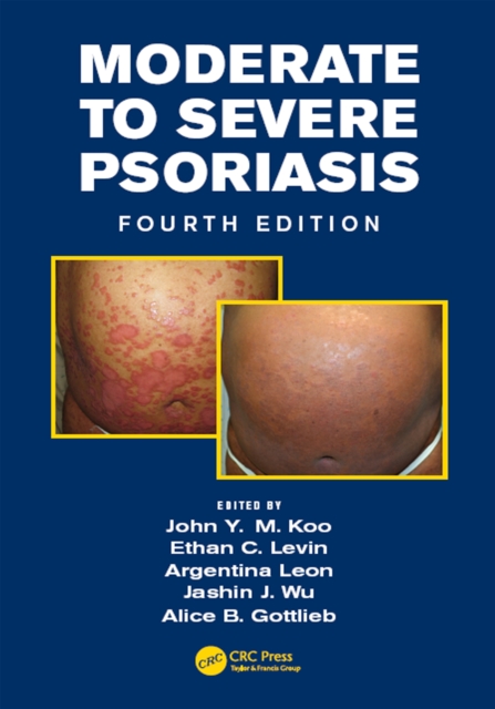 Moderate to Severe Psoriasis, EPUB eBook