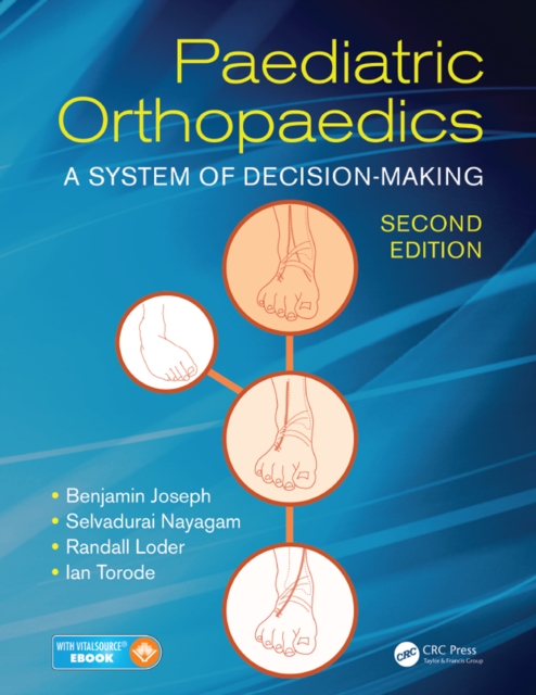 Paediatric Orthopaedics : A System of Decision-Making, Second Edition, EPUB eBook
