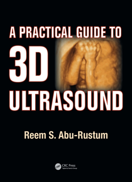 A Practical Guide to 3D Ultrasound, EPUB eBook