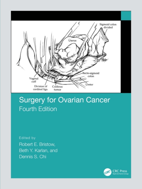 Surgery for Ovarian Cancer, EPUB eBook