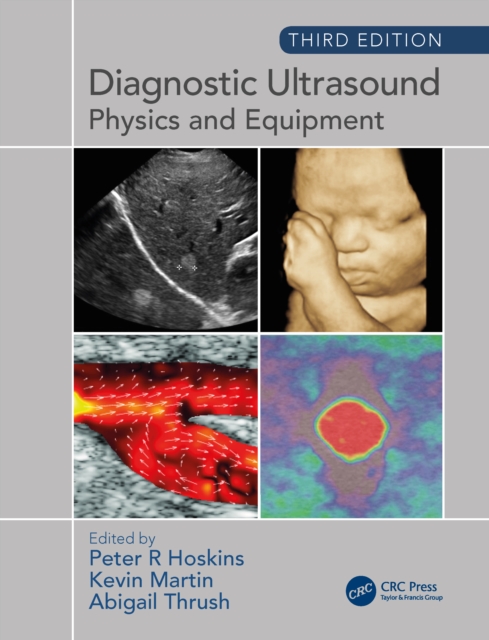 Diagnostic Ultrasound, Third Edition : Physics and Equipment, EPUB eBook