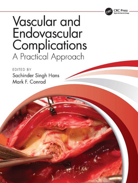 Vascular and Endovascular Complications: A Practical Approach, EPUB eBook