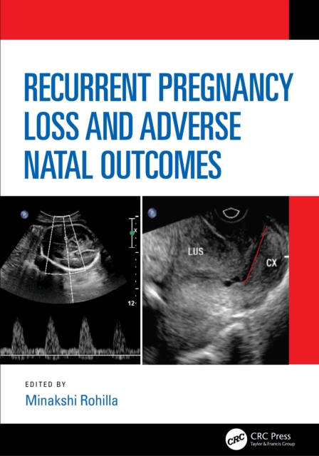 Recurrent Pregnancy Loss and Adverse Natal Outcomes, EPUB eBook