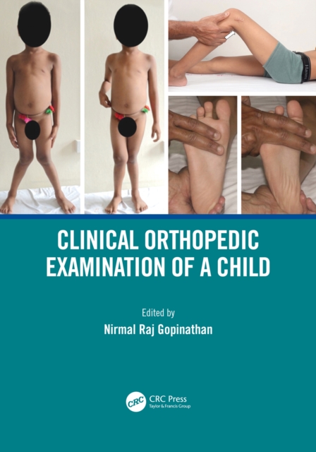 Clinical Orthopedic Examination of a Child, PDF eBook