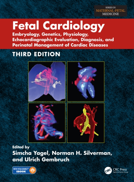 Fetal Cardiology : Embryology, Genetics, Physiology, Echocardiographic Evaluation, Diagnosis, and Perinatal Management of Cardiac Diseases, Third Edition, EPUB eBook