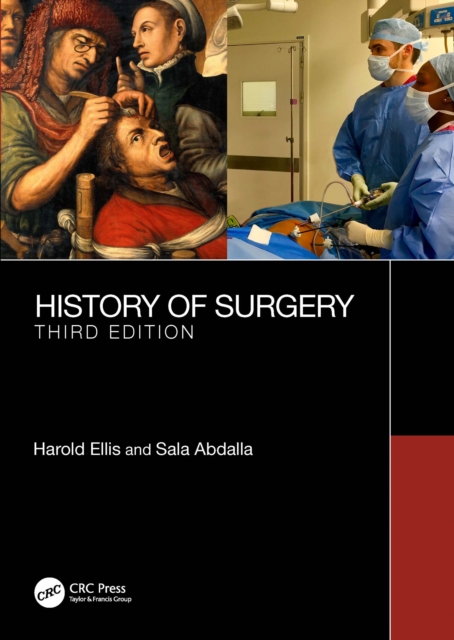 A History of Surgery : Third Edition, EPUB eBook