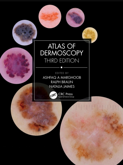 Atlas of Dermoscopy : Third Edition, EPUB eBook