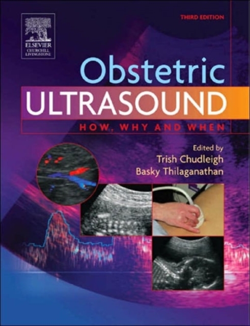 Obstetric Ultrasound, Paperback Book