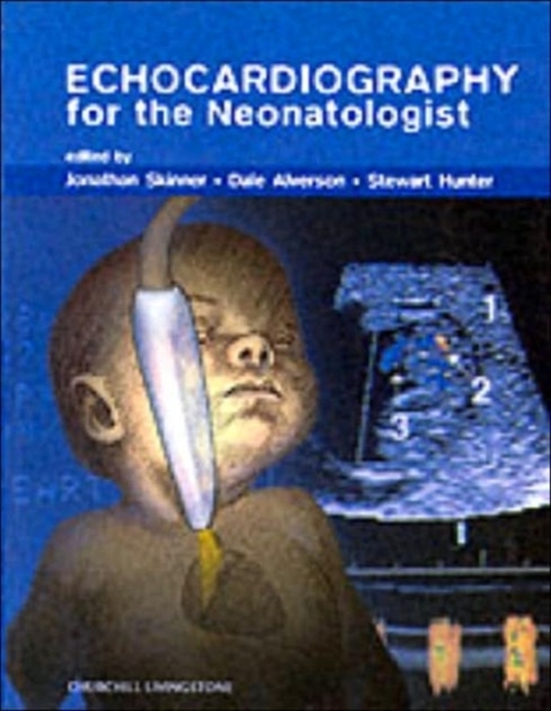 Echocardiography for the Neonatologist, Hardback Book