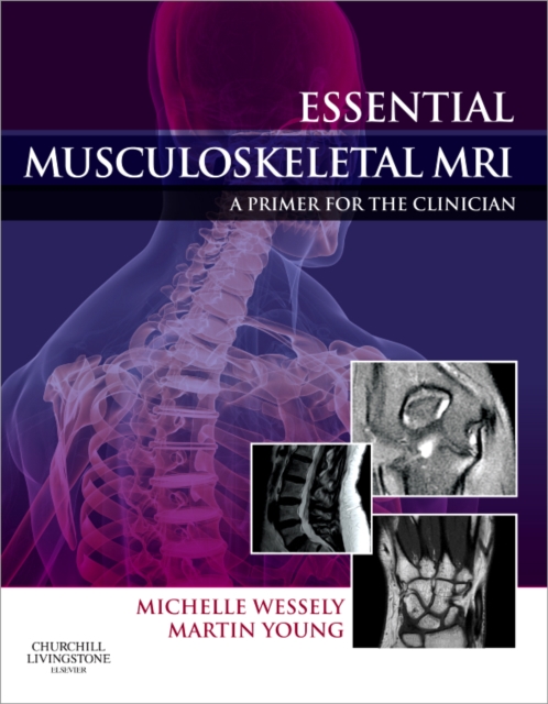 Essential Musculoskeletal MRI : A Primer for the Clinician, Hardback Book