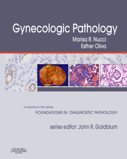 Gynecologic Pathology : A Volume in the Series: Foundations in Diagnostic Pathology, Hardback Book
