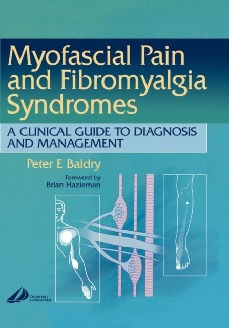 Myofascial Pain and Fibromyalgia Syndromes : A Clinical Guide to Diagnosis and Management, Hardback Book