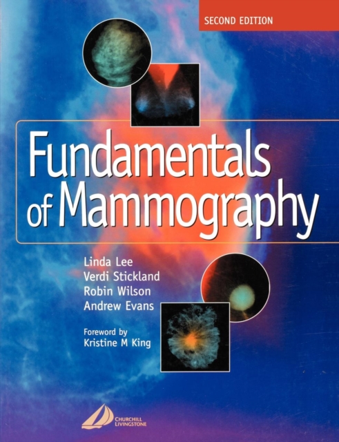 Fundamentals of Mammography, Paperback / softback Book