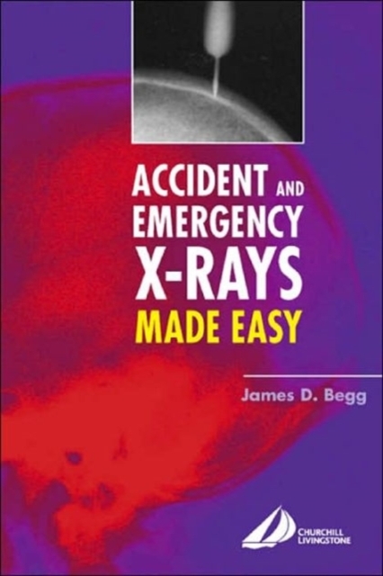 Accident and Emergency X-Rays Made Easy : Accident and Emergency X-Rays Made Easy, Paperback / softback Book