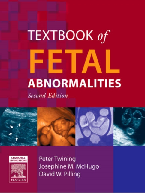 Textbook of Fetal Abnormalities, Hardback Book