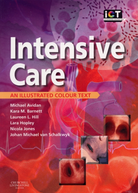 Intensive Care : An Illustrated Colour Text, Paperback Book